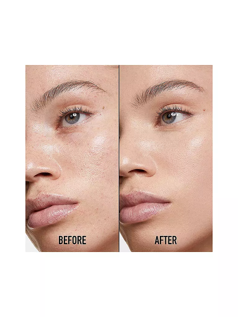 DIOR | Correttore - Dior Forever Skin Correct (1,5 N Neutral) | Cammello