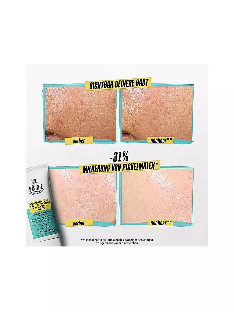 KIEHL'S | Crema viso - Expertly Clear Blemish Treating & Preventing Lotion 60ml | 