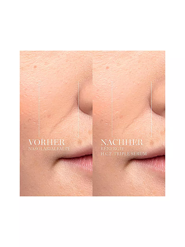 LANCÔME | Rénergie Multi-Lift Ultra Triple Serum 50ml | Senza colore