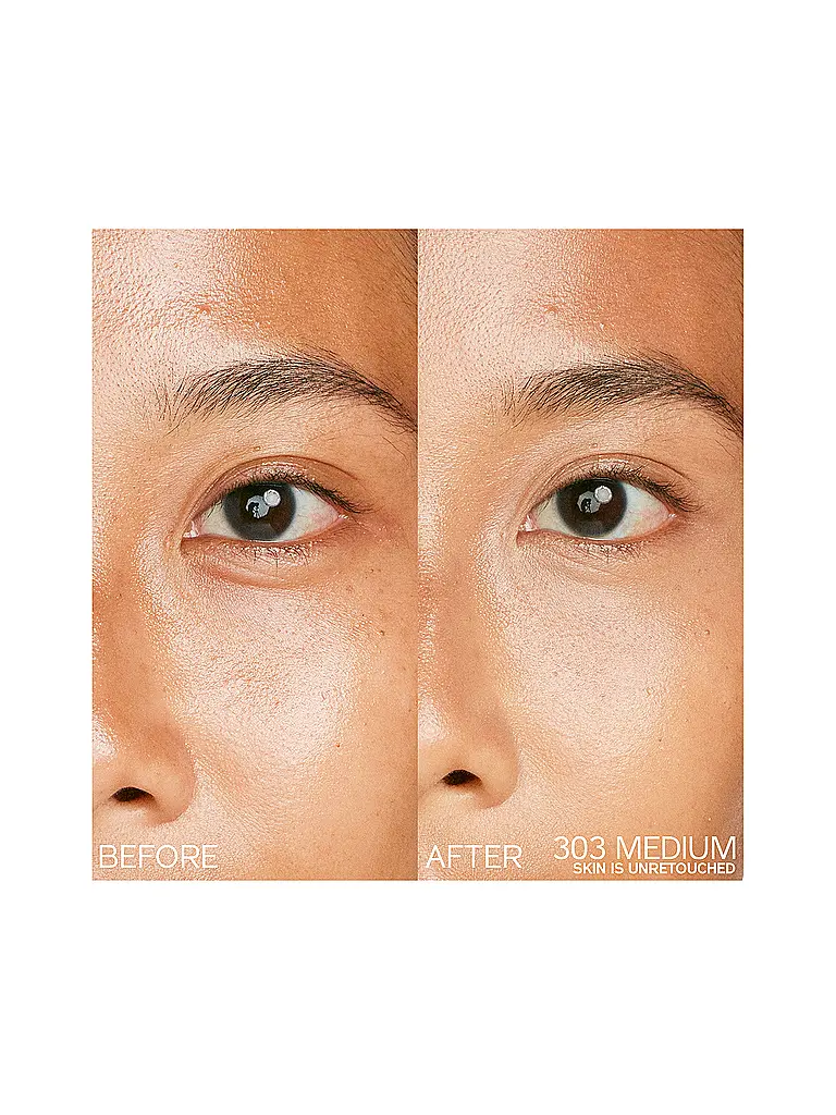 SHISEIDO | Synchro Skin Radiant Lifting Concealer 103 | Senza colore